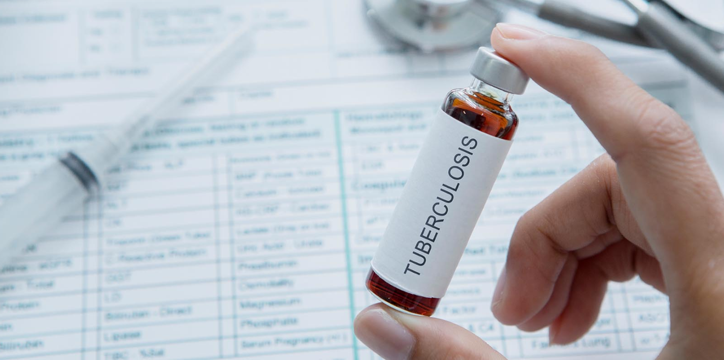 Terapi Pencegahan Tuberkulosis Masih Sangat Minim Terapi Pencegahan Tuberkulosis Masih Sangat Minim